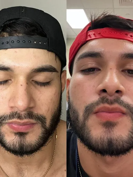 Skin glow, Client result